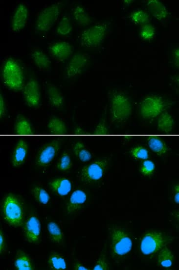 Polyclonal Rabbit anti-Human UCP3 Antibody (IHC, IF, WB)