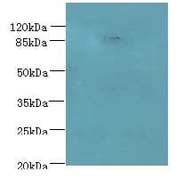 PASD1 Antibody