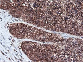 DSTN / Destrin Antibody (clone OTI1G8, Carrier-free)
