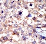 ABL1 / c-ABL Antibody (aa851-881)