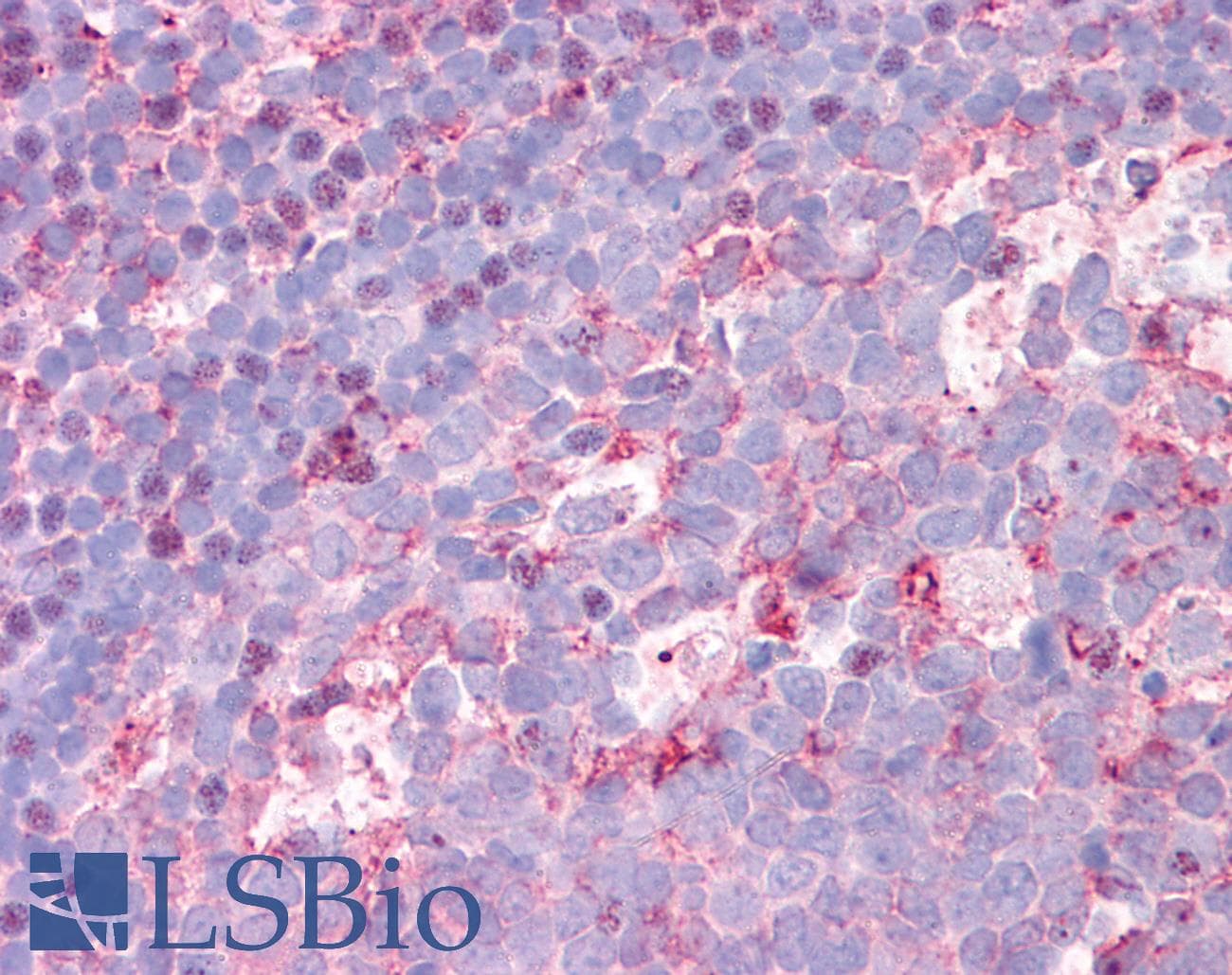 IHC-plus™ SLC31A1 / CTR1 Antibody (C-Terminus)