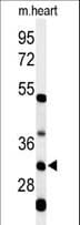 HCCS Antibody (aa173-200)