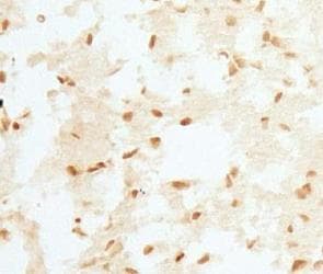 RCAN1 / DSCR1 Antibody (aa210-252)