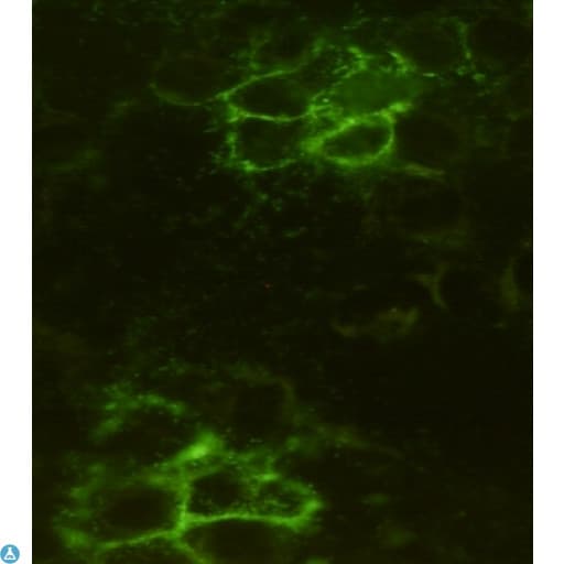 NOG / Noggin Antibody