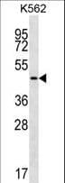 Polyclonal Rabbit anti-Human GIF / Intrinsic Factor Antibody (aa189-218, IHC, IF, WB)
