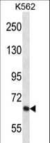 Polyclonal Rabbit anti-Human KCND2 / Kv4.2 Antibody (aa123-151, IHC, WB)