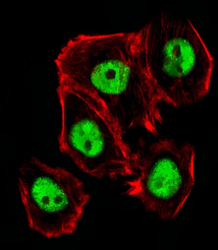 Polyclonal Rabbit anti-Mouse CTR9 Antibody (aa1022-1056, IHC, IF, WB)