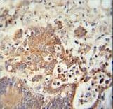 CHCHD2 Antibody (aa74-103)