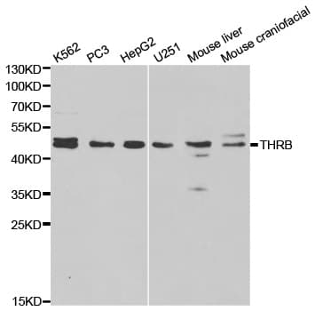 Polyclonal Rabbit anti-Human NR1A2 / THRB Antibody (IHC, WB)