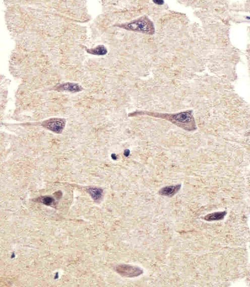 PTK2B / PYK2 Antibody (aa805-838)