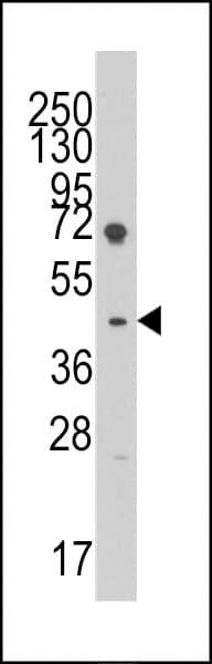 LEFTYB / LEFTY1 Antibody (aa283-314)