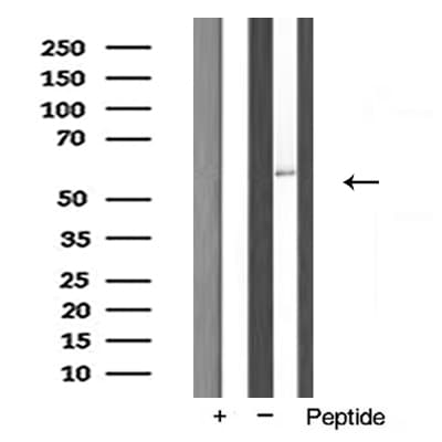 Polyclonal Rabbit anti-Human FASTK / FAST Antibody (WB)