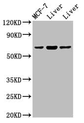 PTHR / PTHR1 Antibody