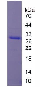 Human CDC20 Protein (Recombinant His, N-Terminal)