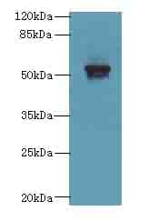 LDHD / Lactate Dehydrogenase D Antibody