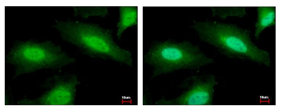PSMF1 Antibody (aa209-271)