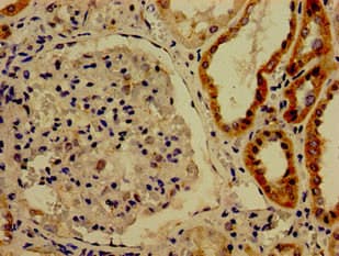 CDK13 / CDC2L5 Antibody
