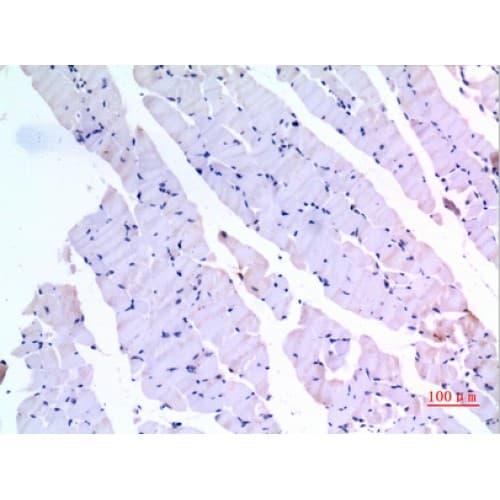 Polyclonal Rabbit anti-Human BMP3 Antibody (411-460 aa, C-terminal, IHC, WB)