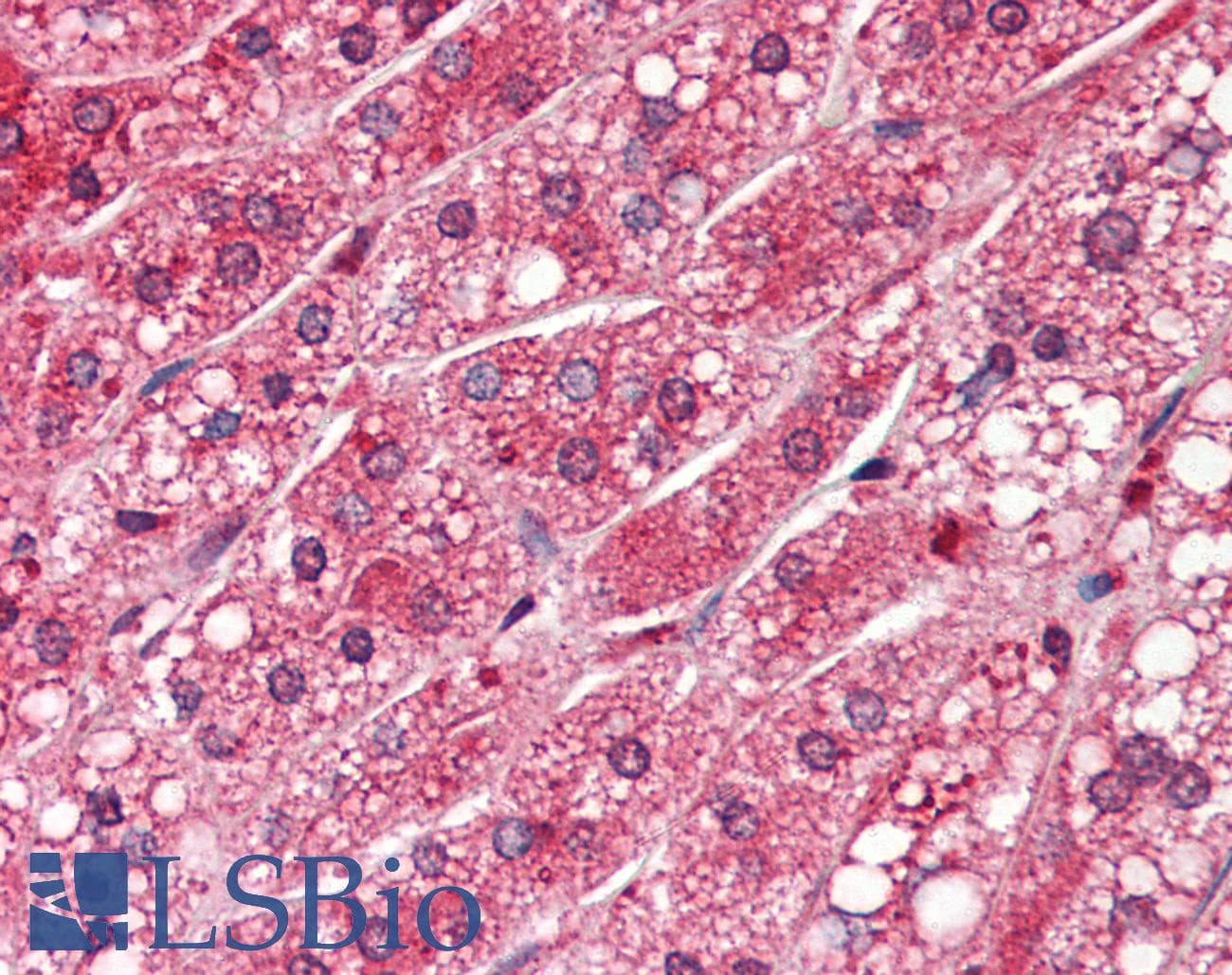 IHC-plus™ Monoclonal Mouse anti-Human PPP1CA / PP1-Alpha Antibody (clone 4G3, aa30-299, IHC, WB)