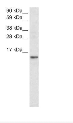 Polyclonal Rabbit anti-Human FABP7 / BLBP / MRG Antibody (aa16-65, WB)