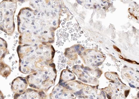 CYP19 / Aromatase Antibody