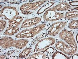 MAP2K1 / MKK1 / MEK1 Antibody (clone OTI5A11)