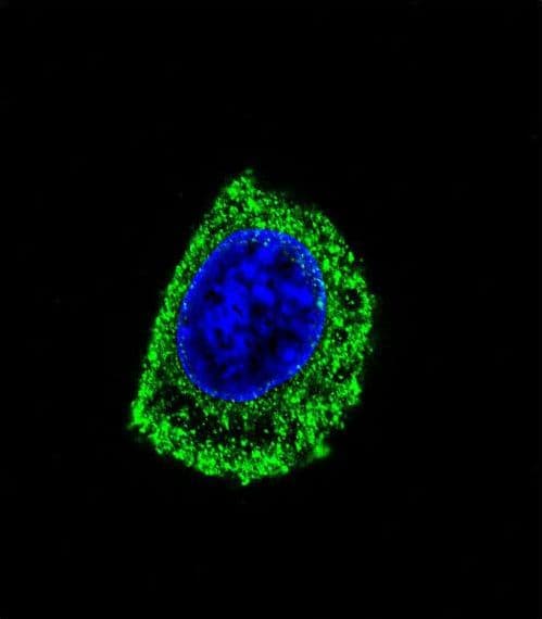 Polyclonal Rabbit anti-Human DDC / DOPA Decarboxylase Antibody (aa32-61, IHC, IF, WB)