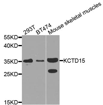 Polyclonal Rabbit anti-Human KCTD15 Antibody (IHC, WB)