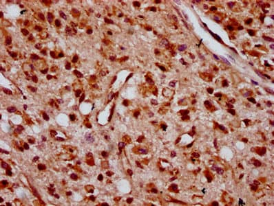 ZNF367 Antibody