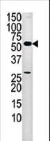Polyclonal Rabbit anti-Human PANK2 Antibody (aa180-210, WB)