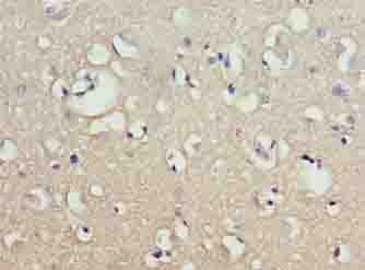 Polyclonal Rabbit anti-Human CNIH2 Antibody (IHC, WB)