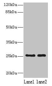 NDFIP1 / N4WBP5 Antibody