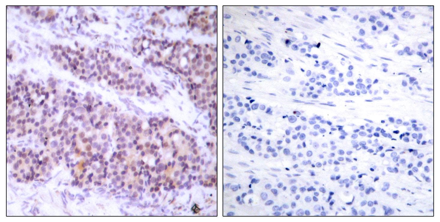BCL2L1 / BCL-XL Antibody (p62)