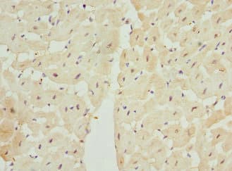 Polyclonal Rabbit anti-Human LECT1 / Chondromodulin-I Antibody (IHC)