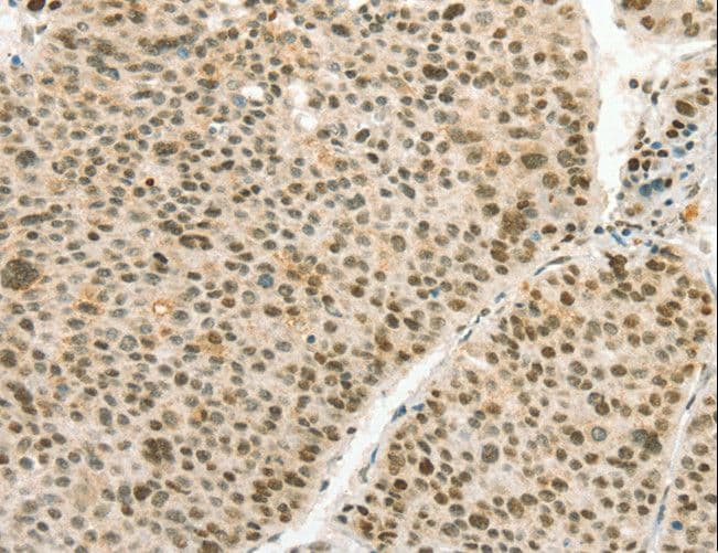 ANGPT4 / Angiopoietin-4 Antibody