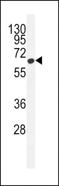 IHC-plus™ Polyclonal Rabbit anti-Human ZC3H12A / MCPIP1 Antibody (aa331-358, IHC, WB)