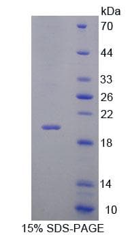 Mouse IL7R / CD127 Protein (Recombinant His)