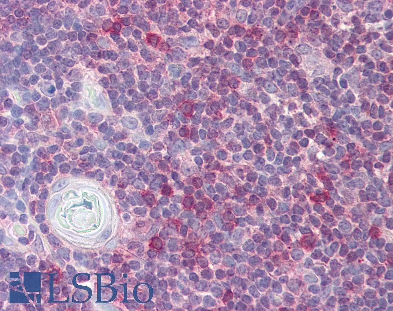 RAN Antibody