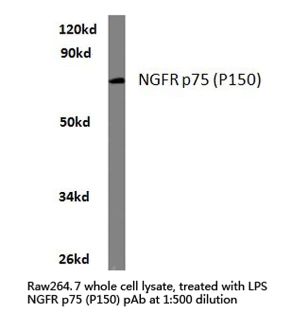 NGFR / CD271 / TNR16 Antibody (Pro150)