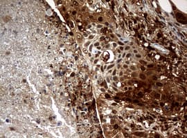 TP / Thymidine Phosphorylase Antibody (clone OTI5B5)
