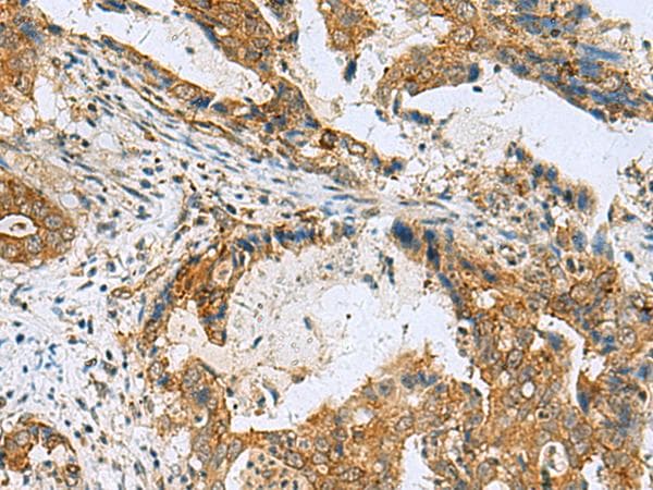 Polyclonal Rabbit anti-Human TUBD1 / Tubulin Delta Antibody (IHC, WB)
