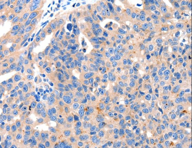KLK2 / Kallikrein 2 Antibody