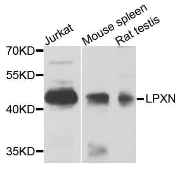 Polyclonal Rabbit anti-Human LPXN / Leupaxin Antibody (WB)