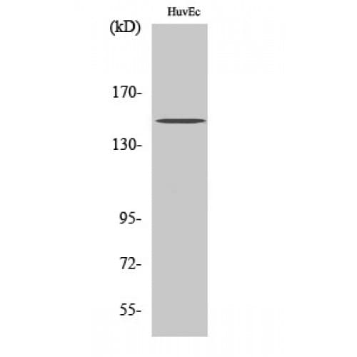 Polyclonal Rabbit anti-Human ARID4B Antibody (Internal, WB)