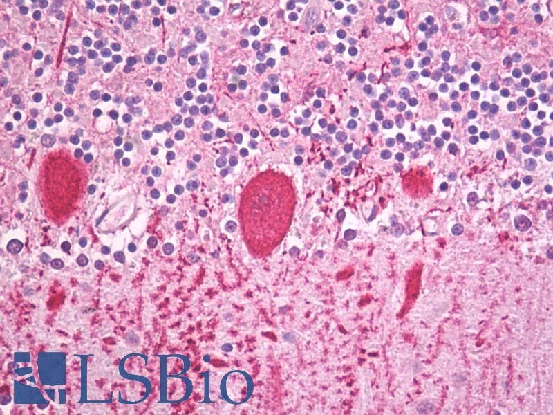 PathPlus™ KCNA1 / Kv1.1 Antibody (aa256-305)