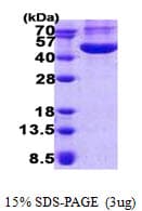 Human CHI3L1 / YKL-40 Protein (Recombinant His)