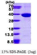 Human SULT1C2 / Sulfotransferase 1C2 Protein (Recombinant His)