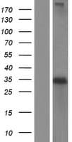 NAT1 / AAC1 Protein (Over-Expression Lysate Myc-DDK (Flag))