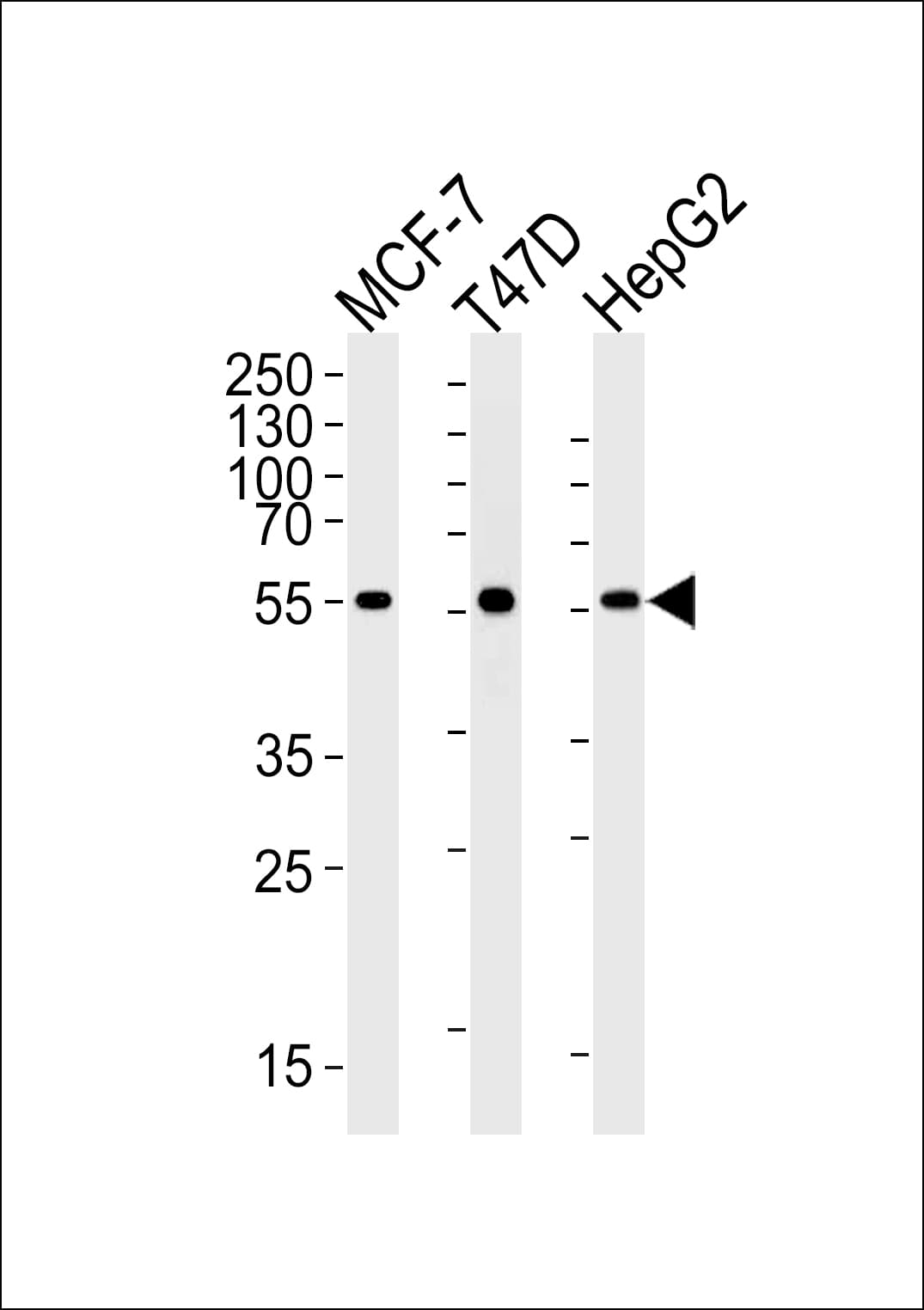 ALDH6A1 Antibody