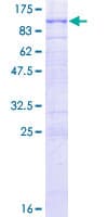 Human RHOBTB1 Protein (Recombinant GST)